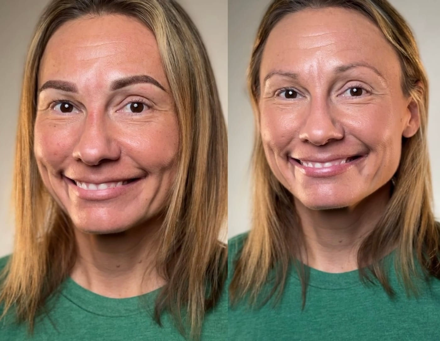 Nano Brows before and after, Frenkel PMU House