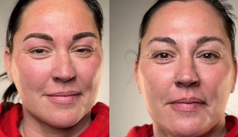 Ombré Brows before and after, Frenkel PMU House