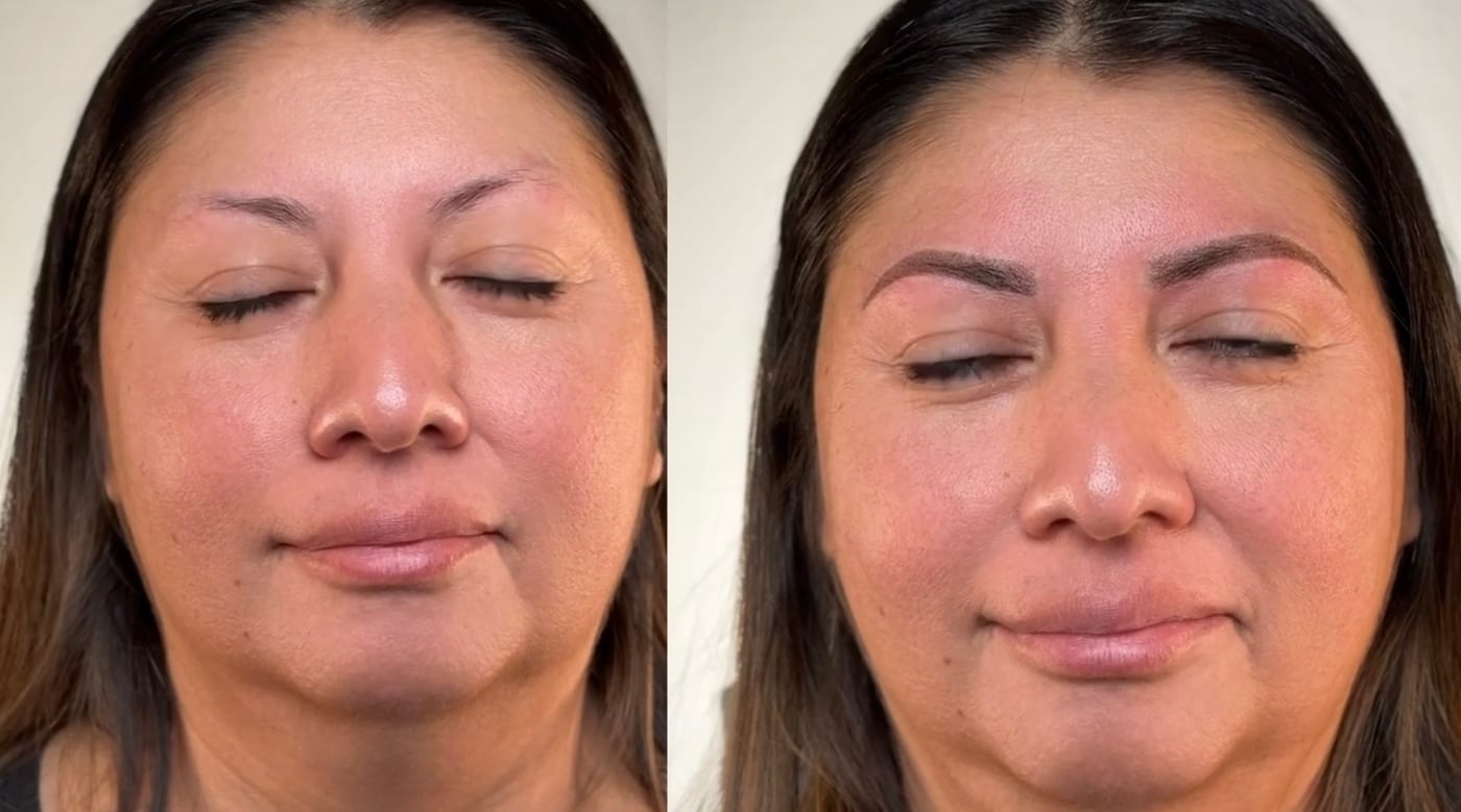 Combo Brows before and after, Frenkel PMU House