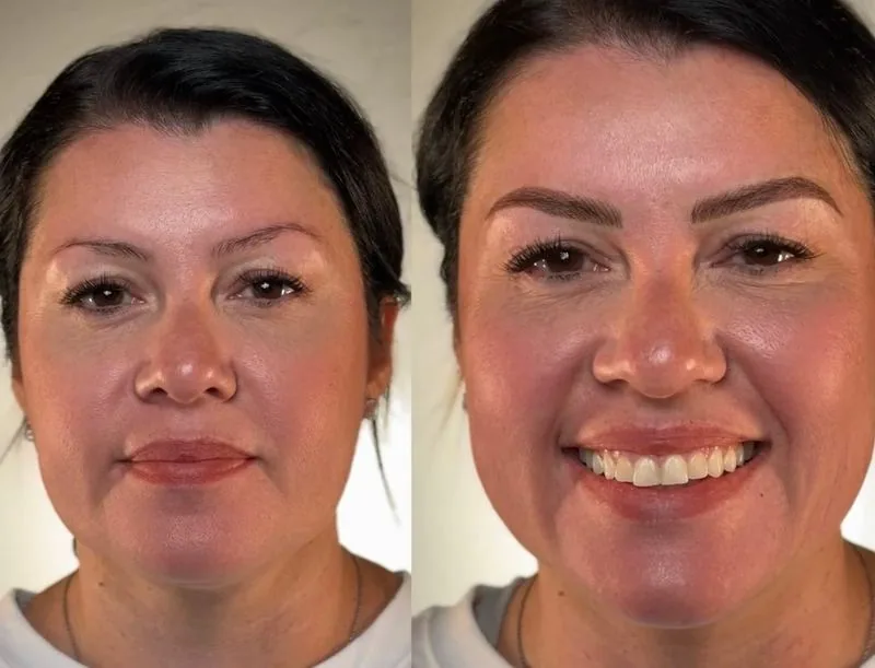 Brow transformation, follow Frenkel PMU House on Instagram
