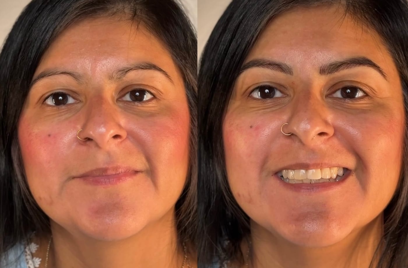 Combo Brows before and after, Frenkel PMU House
