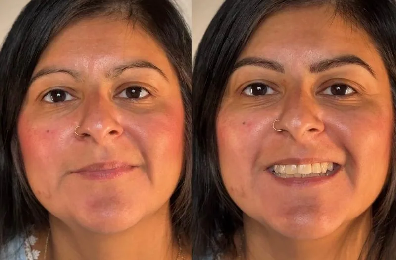 Combo Brows before and after, client result 8, Leander TX