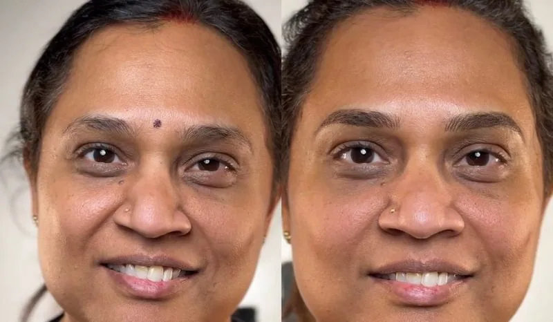 Lip blush transformation, follow Frenkel PMU House on Instagram