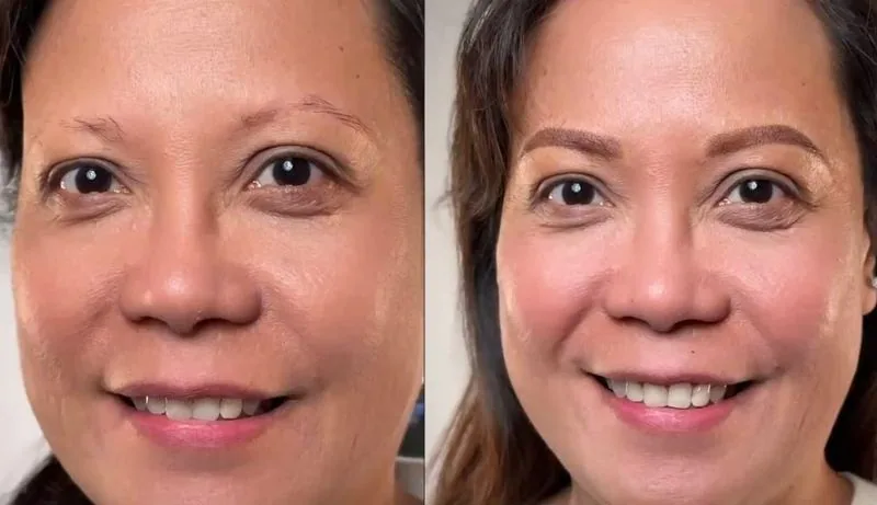 Lip Blush, Healed before and after, Frenkel PMU House