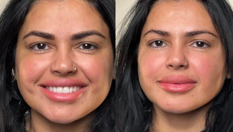 Lip blush transformation, follow Frenkel PMU House on Instagram