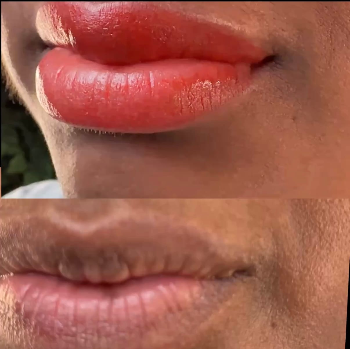 Lip Liner Enhancement before and after, Frenkel PMU House