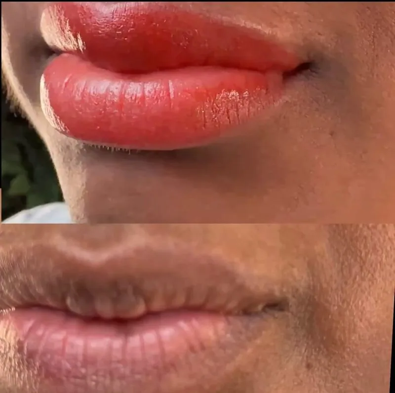 Lip Liner Enhancement before and after, client result 2, Leander TX